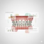 ICD-10 Code M25.561: Pain in Right Knee