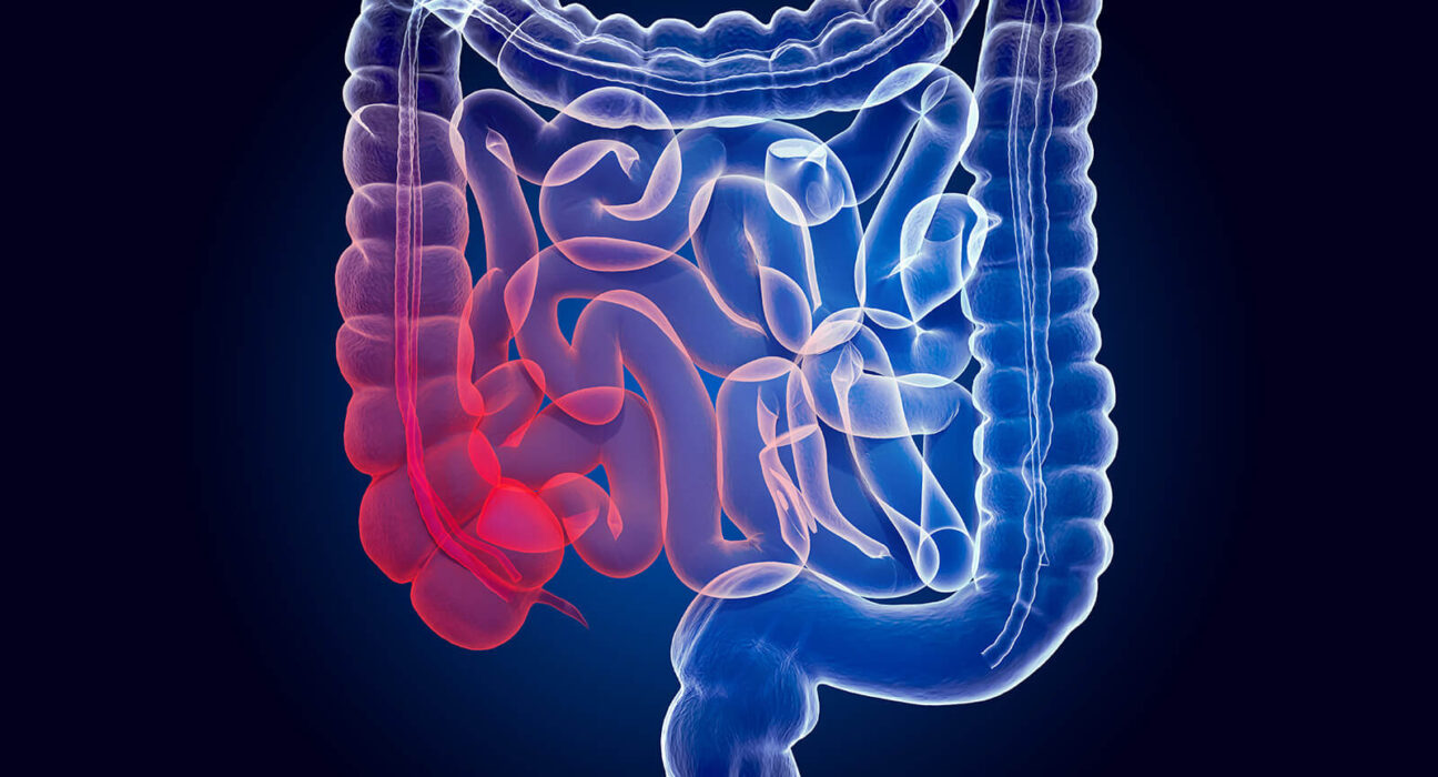 ICD-10 Code for Diarrhea