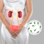 ICD-10 Code for Transaminitis Brief Clinical & Billing Overview