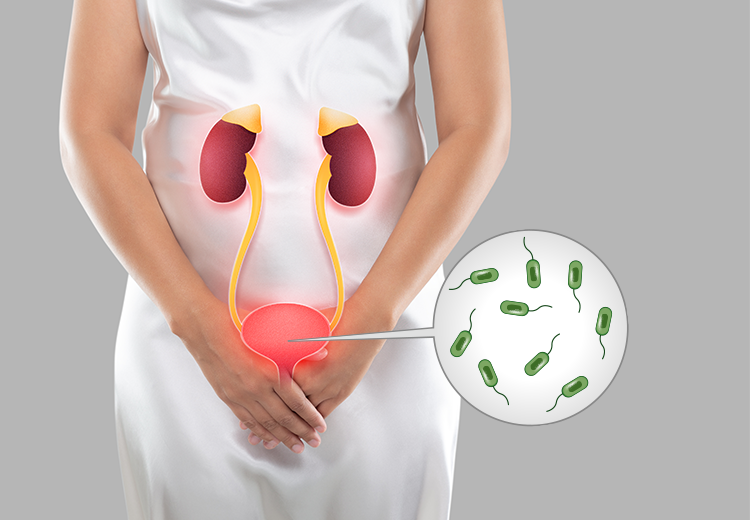 ICD-10 Code for UTI (Urinary Tract Infection)